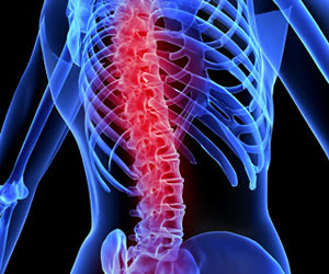 Ảnh 3 của Acute Spinal Cord Injury